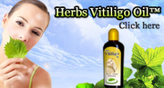Herbs Vitiligo Oil 